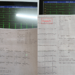 12-Channel ECG 1200G multilingual french