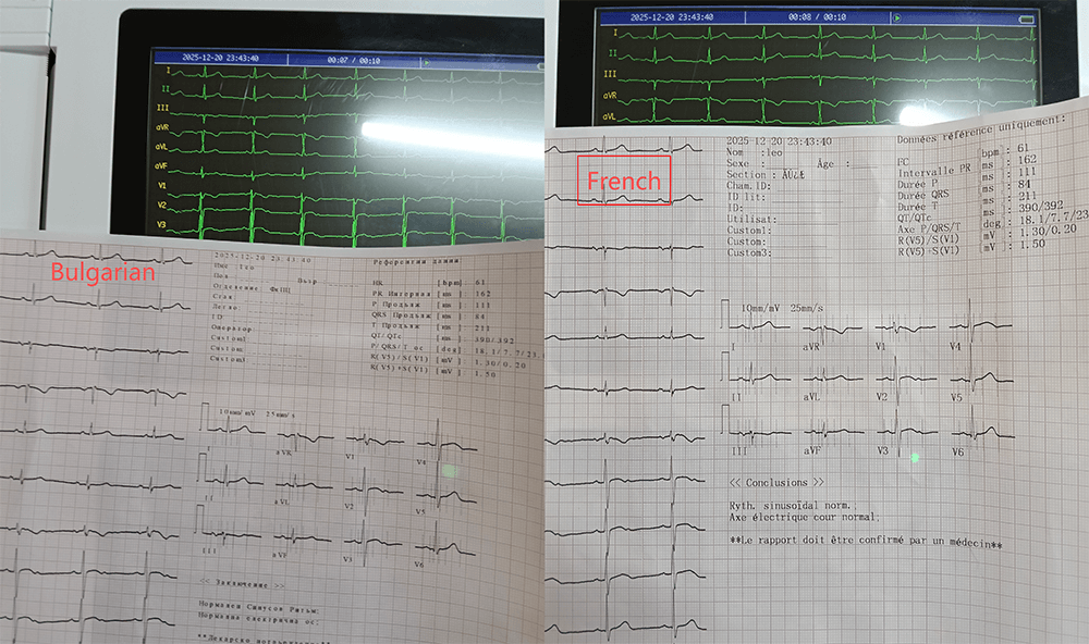 12-Channel ECG 1200G multilingual french