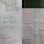 12-Channel ECG 1200G multilingual english german