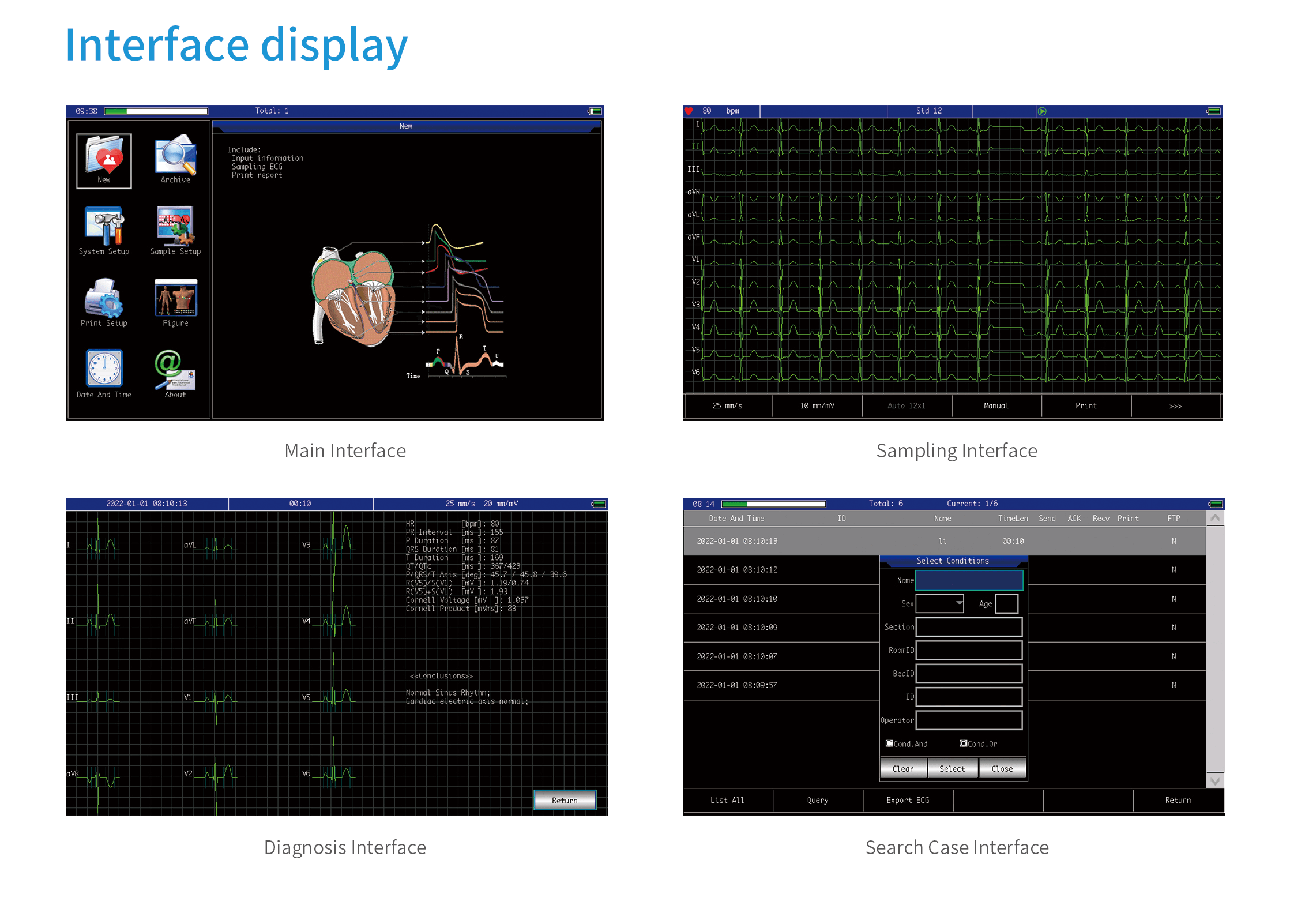 12-Channel ECG 1201G ecg 1201 display
