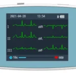 home ecg monitors pm20